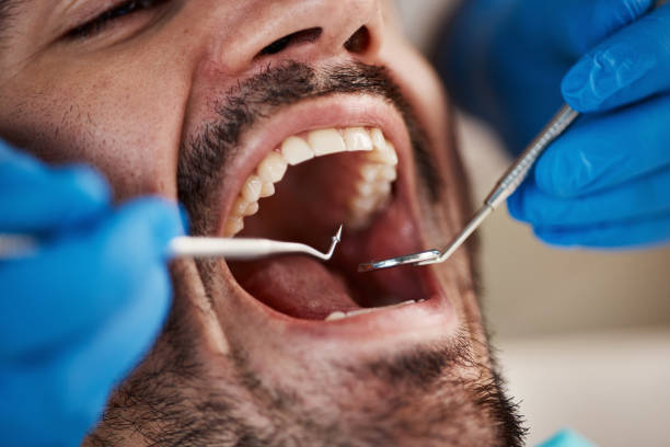 Emergency Dental Services in Colona, IL