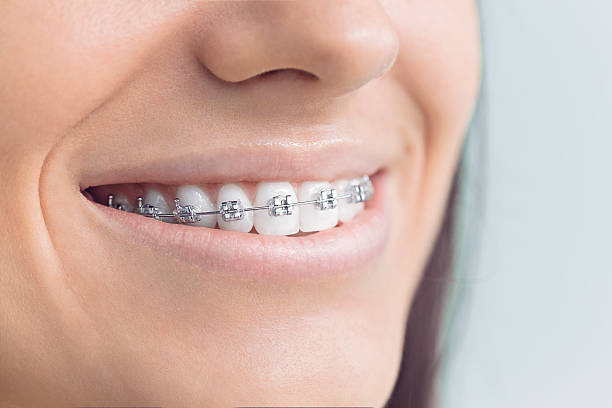 Best Tooth Extraction  in Colona, IL